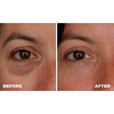 Lunea Vegan Collagen Eye Serum